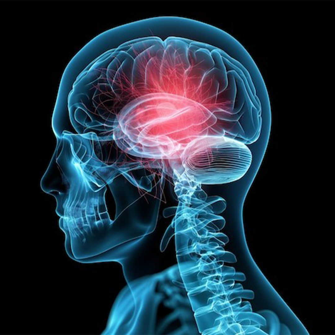 neurology